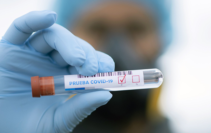 Para el estudio Inmunosenex se han realizado pruebas de PCR y test de anticuerpo a más de 2.500 personas