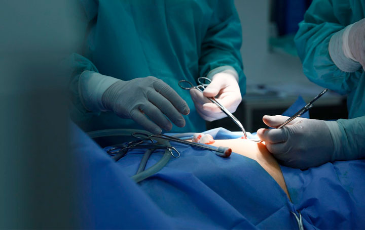 Estudio sobre el delirio postoperatorio.